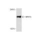 human breast extract: sc-363753. Western blot analysis of MYH15 expression... 