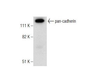human colon extract: sc-363757. Western blot analysis of pan-cadherin expression... 