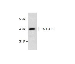 human esophagus extract: sc-363760. Western blot analysis of SLC35C1 expression...