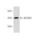 human esophagus extract: sc-363760. Western blot analysis of SLC35C1 expression...