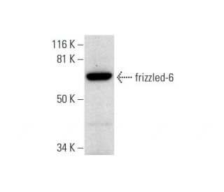 frizzled-6 Antibody (D-2) - Western Blotting - Image 293060 