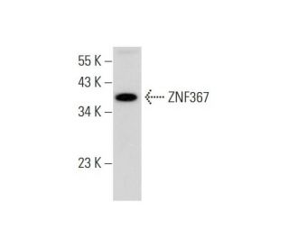 human kidney extract: sc-363764. Western blot analysis of ZNF367 expression... 