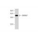 human kidney extract: sc-363764. Western blot analysis of ZNF367 expression... 
