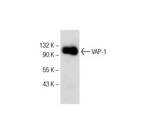 VAP-1 Antibody (A-8) - Western Blotting - Image 151777 