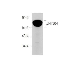 ZNF304 (N-17): sc-244770. Western blot analysis of ZNF304 expression in human ovary tissue extract. 