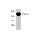 ZNF304 (N-17): sc-244770. Western blot analysis of ZNF304 expression in human ovary tissue extract. 