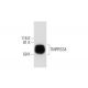 TMPRSS4 Antibody (D-1) - Western Blotting - Image 290970