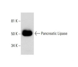 Pancreatic Lipase Antibody (A-3) - Western Blotting - Image 292046 