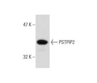 human platelet extract: sc-363773. Western blot analysis of PSTPIP2 expression... 