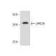 LRRC26 (K-12): sc-132325. Western blot analysis of LRRC26 expression in human prostate tissue extract. 