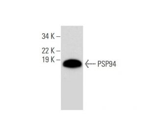 PSP94 Antibody (F-1) - Western Blotting - Image 290842 