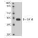 human salivary gland extract: sc-363762. Western blot analysis of CA...