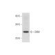DIO2 (H-165): sc-98716. Western blot analysis of DIO2 expression in human skeletal muscle tissue extract.