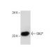 GALP (C-20): sc-139358. Western blot analysis of GALP expression in human skin tissue extract.