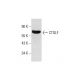 CTGLF (P-18): sc-323761. Western blot analysis of CTGLF expression in human testis tissue extract.