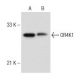 human thyroid extract: sc-363782. Western blot analysis of OR4K1 expression...