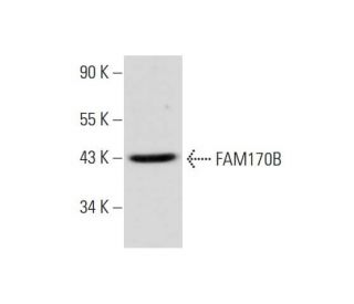 FAM170B (S-15): sc-246634. Western blot analysis of FAM170B expression in human uterus tissue extract. 