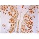 HURP Antibody (D-12) - Immunohistochemistry - Image 296617
