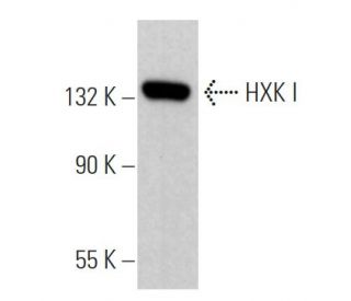HXK I Antibody (A-2) - Western Blotting - Image 363725 