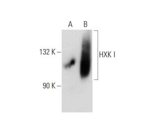 HXK I Antibody (A-7) - Western Blotting - Image 137550 