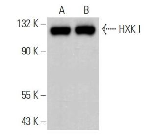HXK I Antibody (A-7) - Western Blotting - Image 363723
