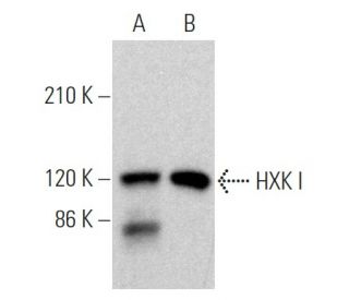 HXK I Antibody (G-1) - Western Blotting - Image 360350