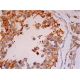 HYAL3 Antibody (E-11) - Immunohistochemistry - Image 293438 
