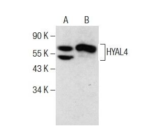 HYAL4 Antibody (A-7) - Western Blotting - Image 283883 