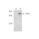 HYLS1 Antibody (E-3) - Western Blotting - Image 309577