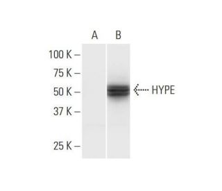 HYPE Antibody (3F5) - Western Blotting - Image 352182 