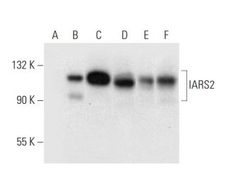 IARS2 Antibody (E-2) - Western Blotting - Image 297010