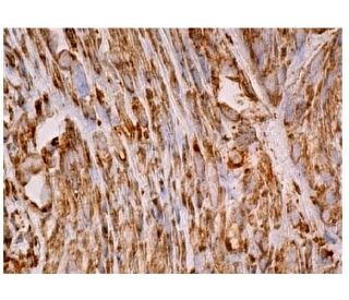 ICA69 Antibody (A-1) - Immunohistochemistry - Image 160202 