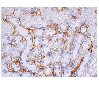 ICAM-1/CD54 Antibody (5K16) - Immunohistochemistry - Image 350558 
