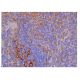 ICAM-1/CD54 Antibody (5K16) - Immunohistochemistry - Image 350557