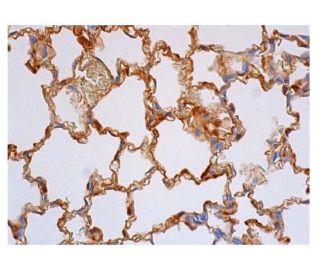 ICAM-1/CD54 Antibody (TLD-3H7A) - Immunohistochemistry - Image 350556