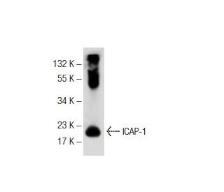 ICAP-1 Antibody (B-2) - Western Blotting - Image 72757