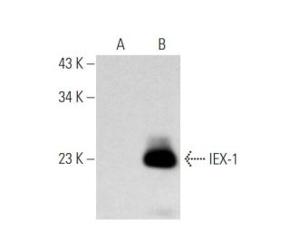 IEX-1 Antibody (E-2) - Western Blotting - Image 353661Each CRISPR/Cas9 Knockout (KO) Plasmid product consists of a pool of 3 plasmids designed to ensure identification and cleavage of a specific gene for maximum knockout efficiency. Each plasmid encodes a unique 20 nt sequence derived from the GeCKO (v2) library.