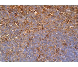 IFI-202 Antibody (F-7) - Immunohistochemistry - Image 386550 