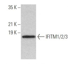 IFITM1/2/3 Antibody (F-12) - Western Blotting - Image 362969