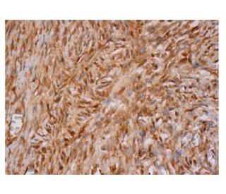 IFN-&alpha; Antibody (F-7) - Immunohistochemistry - Image 350222 