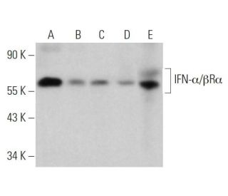 IFN-&alpha;/&beta;R&alpha; Antibody (H-11) - Western Blotting - Image 360159 