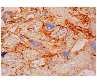IFN-&alpha;/&beta;R&beta; Antibody (F-7) - Immunohistochemistry - Image 310491 