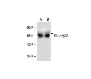 IFN-&alpha;/&beta;R&beta; Antibody (G-4) - Western Blotting - Image 154942