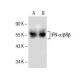 IFN-α/βRβ Antibody (G-4) - Western Blotting - Image 154942