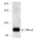 IFN-α2 Antibody (MT4/E4) - Western Blotting - Image 12796