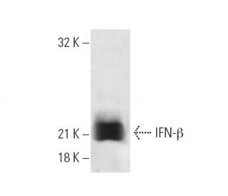 IFN-&beta; Antibody (7F-D3) - Western Blotting - Image 19272