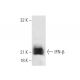 IFN-β Antibody (7F-D3) - Western Blotting - Image 19272