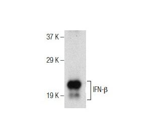 IFN-&beta; Antibody (A1) - Western Blotting - Image 156200
