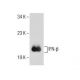 IFN-β Antibody (MIB-2B2.2) - Western Blotting - Image 156197