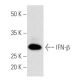IFN-β Antibody (MIB-2B2.2) - Western Blotting - Image 354751 